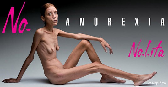 No anorexia