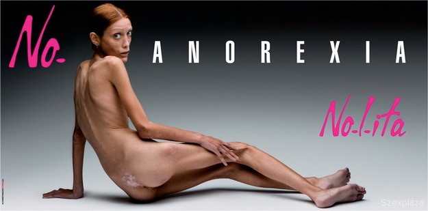 Elhunyt a 28 éves, anorexiás modell